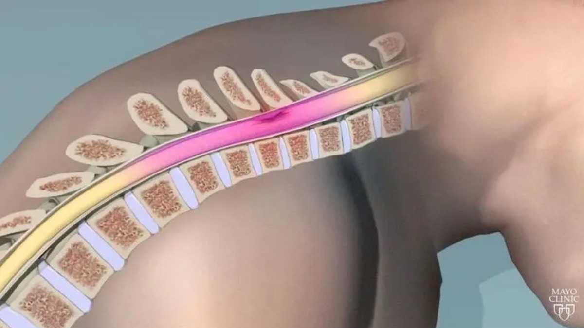 archivo infogate web-5-2-34-23