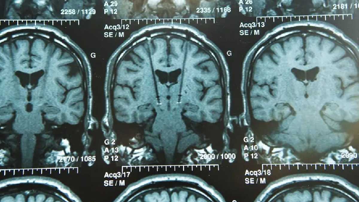 archivo infogate web-5-2-34-52