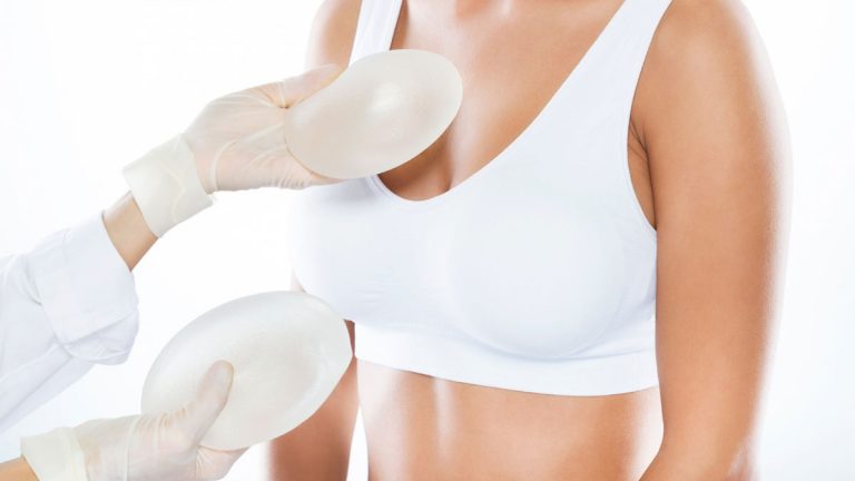 Conozca 5 mitos y verdades sobre los implantes de senos